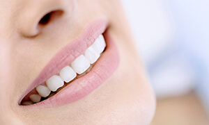 Close up of smile with straight white teeth