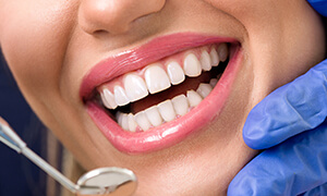 Close up of woman smiling while visiting cosmetic dentist