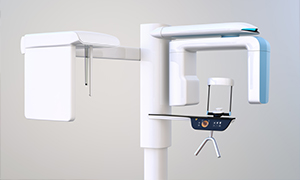 3 D cone beam dental scanner