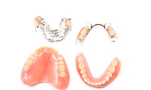 Two full dentures and two partial dentures