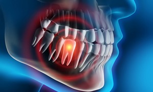 Computer image of a highlighted toothache 