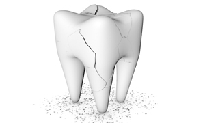 Digital image of a cracked tooth   