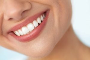 Woman smiling with white teeth