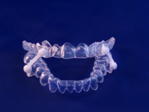 custom oral appliance for sleep apnea