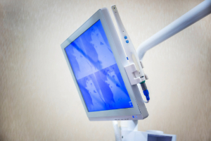 Monitor in dentist’s office with intraoral camera attached